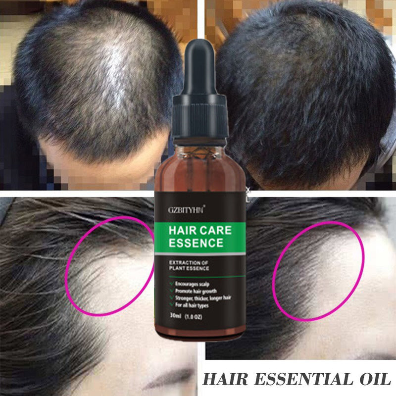 Hair Growth Oil – Effective Hair Care for Healthy, Strong Hair